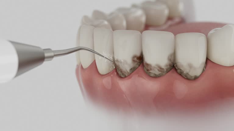 Trusted Dental Crowns And Bridges service in Dover Beaches South, NJ - Dentist Open Now